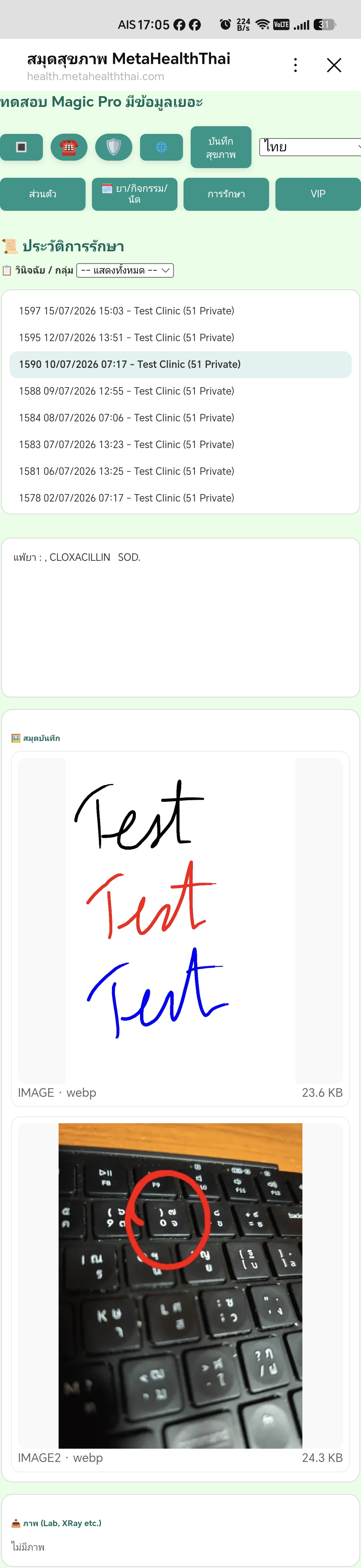 ตรวจสอบประวัติที่บันทึก